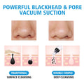 PoreVacuum™ Acne Pimple Removal